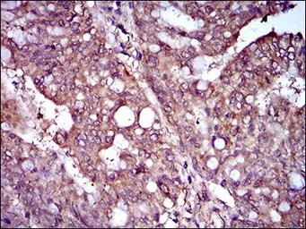 Anti-Rex1 antibody [5E11E7] used in IHC (Paraffin sections) (IHC-P). GTX60780