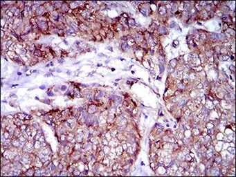 Anti-Rex1 antibody [5E11E7] used in IHC (Paraffin sections) (IHC-P). GTX60780