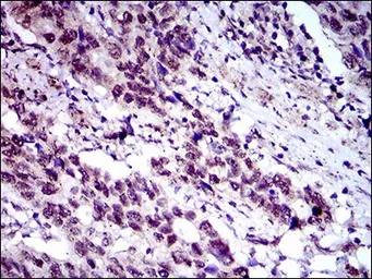 Anti-FLIP antibody [7A3D12] used in IHC (Paraffin sections) (IHC-P). GTX60781