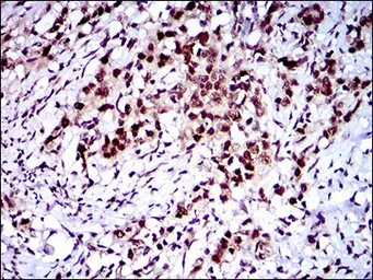 Anti-FLIP antibody [7A3D12] used in IHC (Paraffin sections) (IHC-P). GTX60781