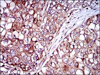 Anti-Rex1 antibody [5E11A6] used in IHC (Paraffin sections) (IHC-P). GTX60783