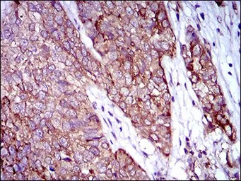 Anti-Rex1 antibody [5E11A6] used in IHC (Paraffin sections) (IHC-P). GTX60783