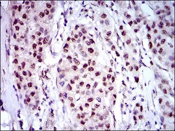 Anti-Napsin A antibody [10C4B8] used in IHC (Paraffin sections) (IHC-P). GTX60785