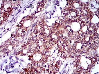 Anti-FLIP antibody [6G11A6] used in IHC (Paraffin sections) (IHC-P). GTX60787