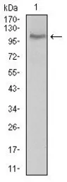 Anti-CLGN antibody [1C8B6] used in Western Blot (WB). GTX60793
