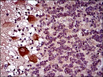 Anti-DRP1 antibody [4E11B11] used in IHC (Paraffin sections) (IHC-P). GTX60794