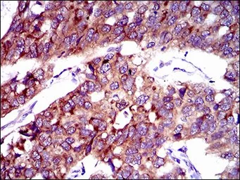 Anti-SLC27A2 antibody [6B3A9] used in IHC (Paraffin sections) (IHC-P). GTX60795