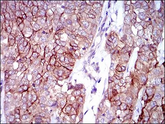 Anti-CD166 antibody [4H9A5] used in IHC (Paraffin sections) (IHC-P). GTX60798
