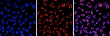 Anti-5-Methylcytosine / 5-mC antibody [GT9076] used in Immunocytochemistry/ Immunofluorescence (ICC/IF). GTX60803