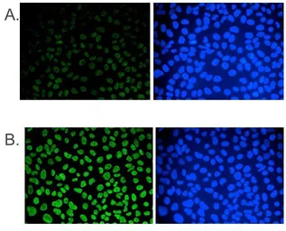 Anti-5-Methylcytosine / 5-mC antibody [GT9076] used in Immunocytochemistry/ Immunofluorescence (ICC/IF). GTX60803