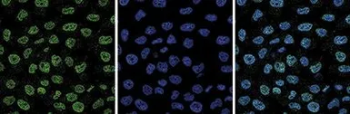 Anti-EZH2 antibody - ChIP grade used in Immunocytochemistry/ Immunofluorescence (ICC/IF). GTX60811