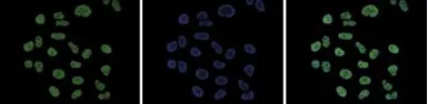 Anti-Histone H3K18ac (Acetyl Lys18) antibody - ChIP grade used in Immunocytochemistry/ Immunofluorescence (ICC/IF). GTX60814