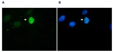 Anti-Histone H3S10ph (phospho Ser10) antibody - ChIP grade used in Immunocytochemistry/ Immunofluorescence (ICC/IF). GTX60827