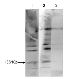 Anti-Histone H3S10ph (phospho Ser10) antibody - ChIP grade used in Immunoprecipitation (IP). GTX60827