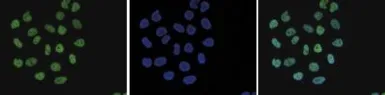 Anti-Histone H4K8ac (acetyl Lys8) antibody - ChIP grade used in Immunocytochemistry/ Immunofluorescence (ICC/IF). GTX60829