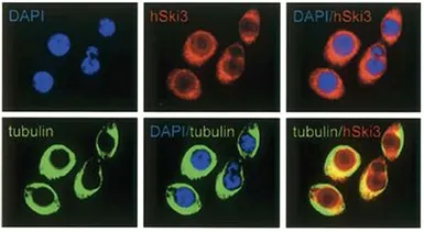 Anti-Ski3 antibody used in Immunocytochemistry/ Immunofluorescence (ICC/IF). GTX60845