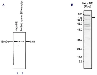 Anti-Ski3 antibody used in Western Blot (WB). GTX60845