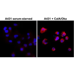 Anti-Phosphothreonine antibody [RM102] used in Immunocytochemistry/ Immunofluorescence (ICC/IF). GTX60860