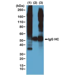 Anti-Phosphothreonine antibody [RM102] used in Immunoprecipitation (IP). GTX60860