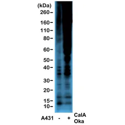 Anti-Phosphothreonine antibody [RM102] used in Western Blot (WB). GTX60860