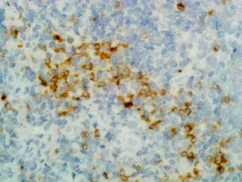 Rabbit Anti-Human IgG (Fc) antibody [RM116]. GTX60861