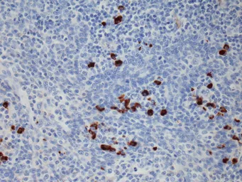 Rabbit Anti-Human IgG1 antibody [RM117]. GTX60862