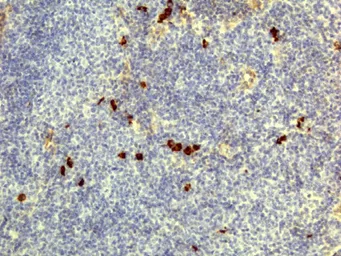 Rabbit Anti-Human IgD antibody [RM123]. GTX60868