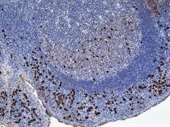 Rabbit Anti-Human IgA1 antibody [RM124]. GTX60869