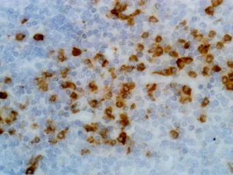 Rabbit Anti-Human kappa light chain antibody [RM126]. GTX60871