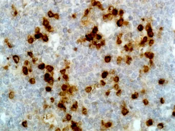 Rabbit Anti-Human lambda light chain antibody [RM127]. GTX60872