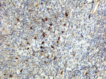 Rabbit Anti-Human IgA antibody [RM128]. GTX60873