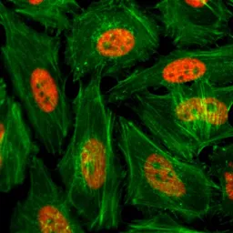 Anti-Histone H3K4me1 (Mono-methyl Lys4) antibody [RM140] used in Immunocytochemistry/ Immunofluorescence (ICC/IF). GTX60878