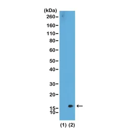 Anti-Histone H3K36me2 (Di-methyl Lys36) antibody [RM141] used in Western Blot (WB). GTX60879
