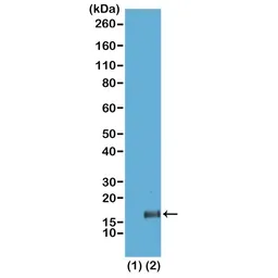 Anti-Histone H3K36me3 (Tri-methyl Lys36) antibody [RM155] used in Western Blot (WB). GTX60882
