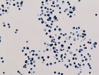 Anti-Histone H3K18ac (Acetyl Lys18) antibody [RM166] used in Immunocytochemistry/ Immunofluorescence (ICC/IF). GTX60886