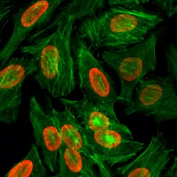 Anti-Histone H3K9me2 (Di-methyl Lys9) antibody [RM151] used in Immunocytochemistry/ Immunofluorescence (ICC/IF). GTX60890