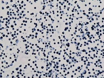 Anti-Histone H3K79me2 (Di-methyl Lys79) antibody [RM181] used in Immunocytochemistry/ Immunofluorescence (ICC/IF). GTX60895