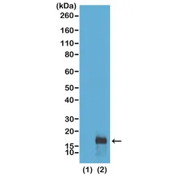 Anti-Histone H3K79me2 (Di-methyl Lys79) antibody [RM181] used in Western Blot (WB). GTX60895