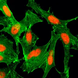 Anti-Histone H4K12ac (Acetyl Lys12) antibody [RM202] used in Immunocytochemistry/ Immunofluorescence (ICC/IF). GTX60912