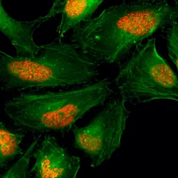 Anti-Histone H2A.X antibody [RM214] used in Immunocytochemistry/ Immunofluorescence (ICC/IF). GTX60914