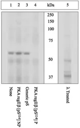 Anti-PKA 2 beta (phospho Ser114) antibody used in Western Blot (WB). GTX60925