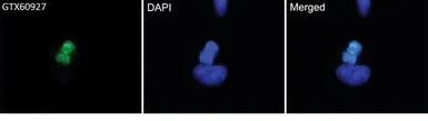 Anti-Histone H3S28ph (phospho Ser28) antibody [HTA28] used in Immunocytochemistry/ Immunofluorescence (ICC/IF). GTX60927