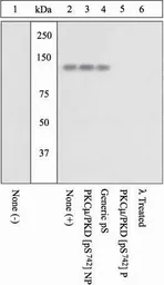 Anti-PKC mu (phospho Ser742) antibody used in Western Blot (WB). GTX60928