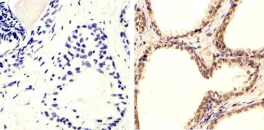 Anti-PTEN (phospho Ser370) antibody used in IHC (Paraffin sections) (IHC-P). GTX60929