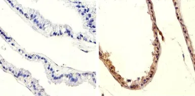 Anti-PTEN (phospho Ser370) antibody used in IHC (Paraffin sections) (IHC-P). GTX60929