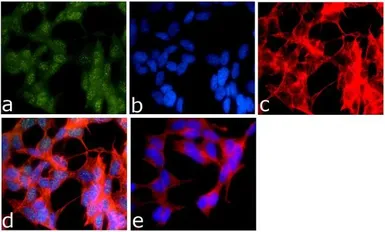 Anti-PTEN (phospho Ser370) antibody used in Immunocytochemistry/ Immunofluorescence (ICC/IF). GTX60929