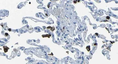 Anti-FCN1 antibody [1] used in IHC (Paraffin sections) (IHC-P). GTX60944