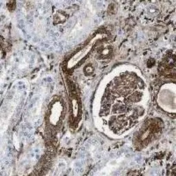 Anti-Gelsolin antibody [20] used in Immunohistochemistry (IHC). GTX60945