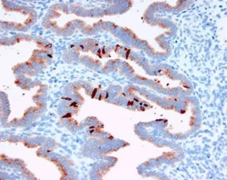 Anti-Glycodelin antibody [16] used in IHC (Paraffin sections) (IHC-P). GTX60957