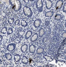 Anti-Peptide YY antibody [1] used in IHC (Paraffin sections) (IHC-P). GTX60975